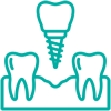 dental-implant
